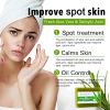 KYLIEFIT Natural Aloe Vera Soap Bar- Face, Hand, and Body Wash - Cleansing & Moisturizing, Anti Spots, Smooth Skin, 200g /7 oz